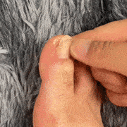 Kit de 3 Cortaúñas en Ángulo para Uñas Encarnadas o Gruesas | SeniorClip™